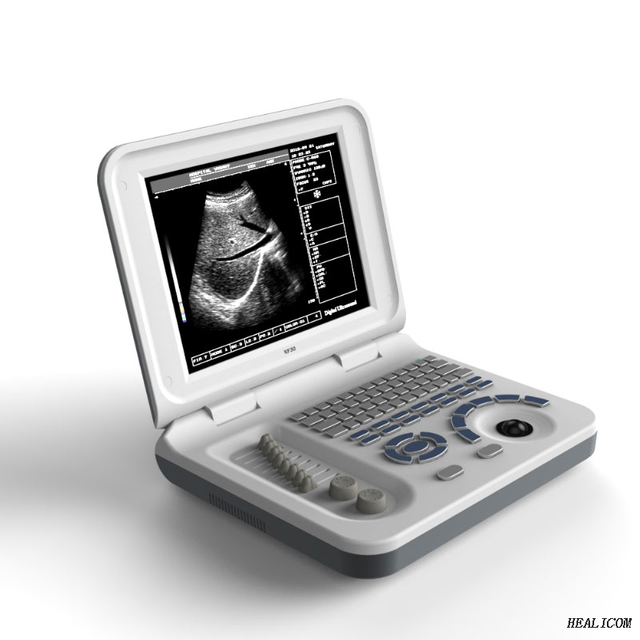 Machine portative de scanner à ultrasons 3D d'équipement de diagnostic de vente chaude HBW-3