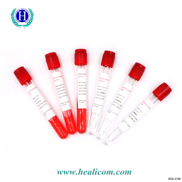 Kits d'écouvillons d'échantillonnage de virus jetables Virus Utm Kits de test d'échantillonnage viral de supports de tube de transport universels avec écouvillon nasal