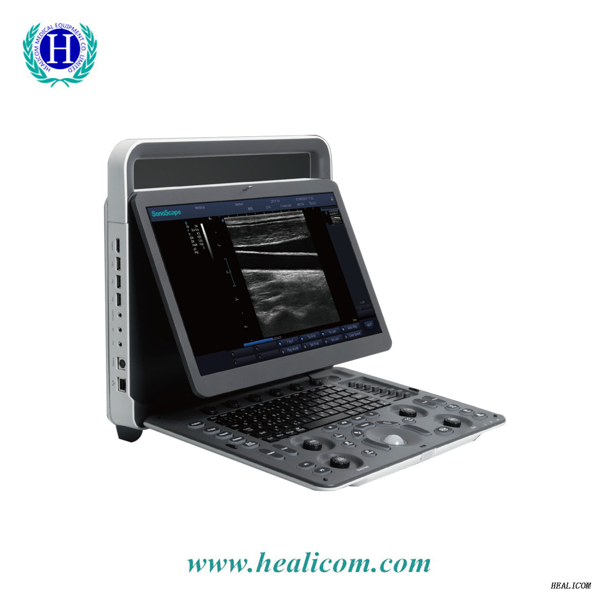 E1 Sonoscape Medical Système de scanner à ultrasons portable prix de la machine à sonde à ultrasons noir et blanc