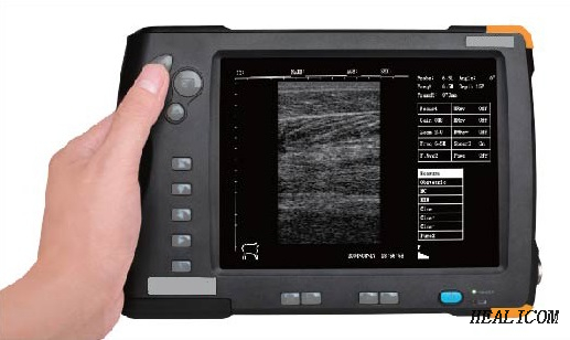 HV-5 équipement médical vétérinaire Portable animal portable système de sonar vétérinaire N/B/scanner à ultrasons
